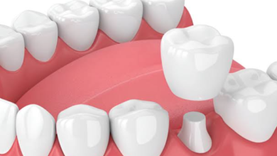 New Dental Crowns: Essential Tips for Long-Lasting Results